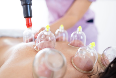 cupping massage plano
